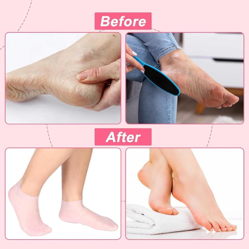 100% Pure Silicone Moisturizing Gel Heel Socks Exfoliating And Preventing Dryness Foot Skin Rejuvenation Foot Care Elastic Sock